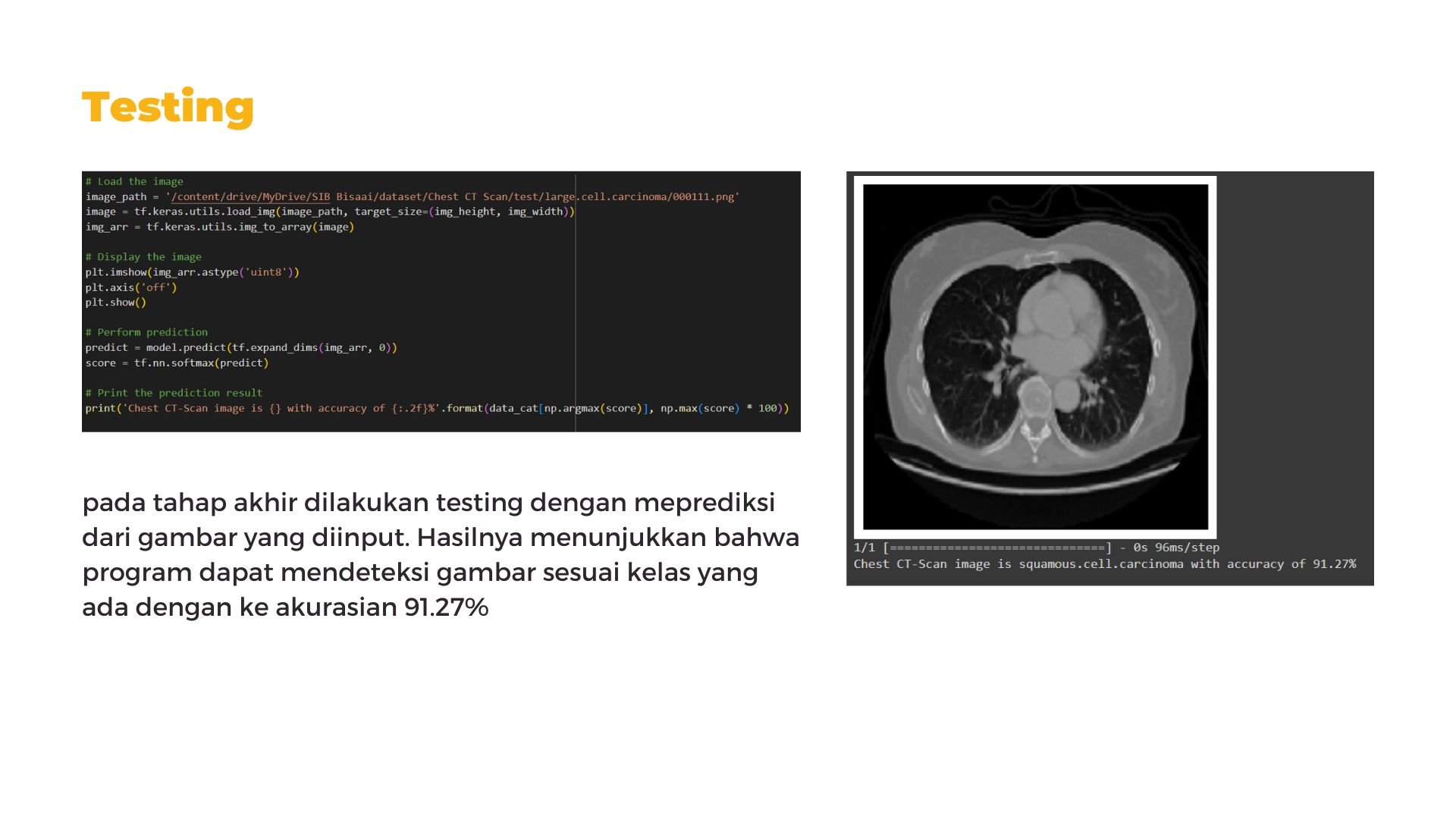Portofolio Detail >> Chest CT Scan Classification with Deep Learning