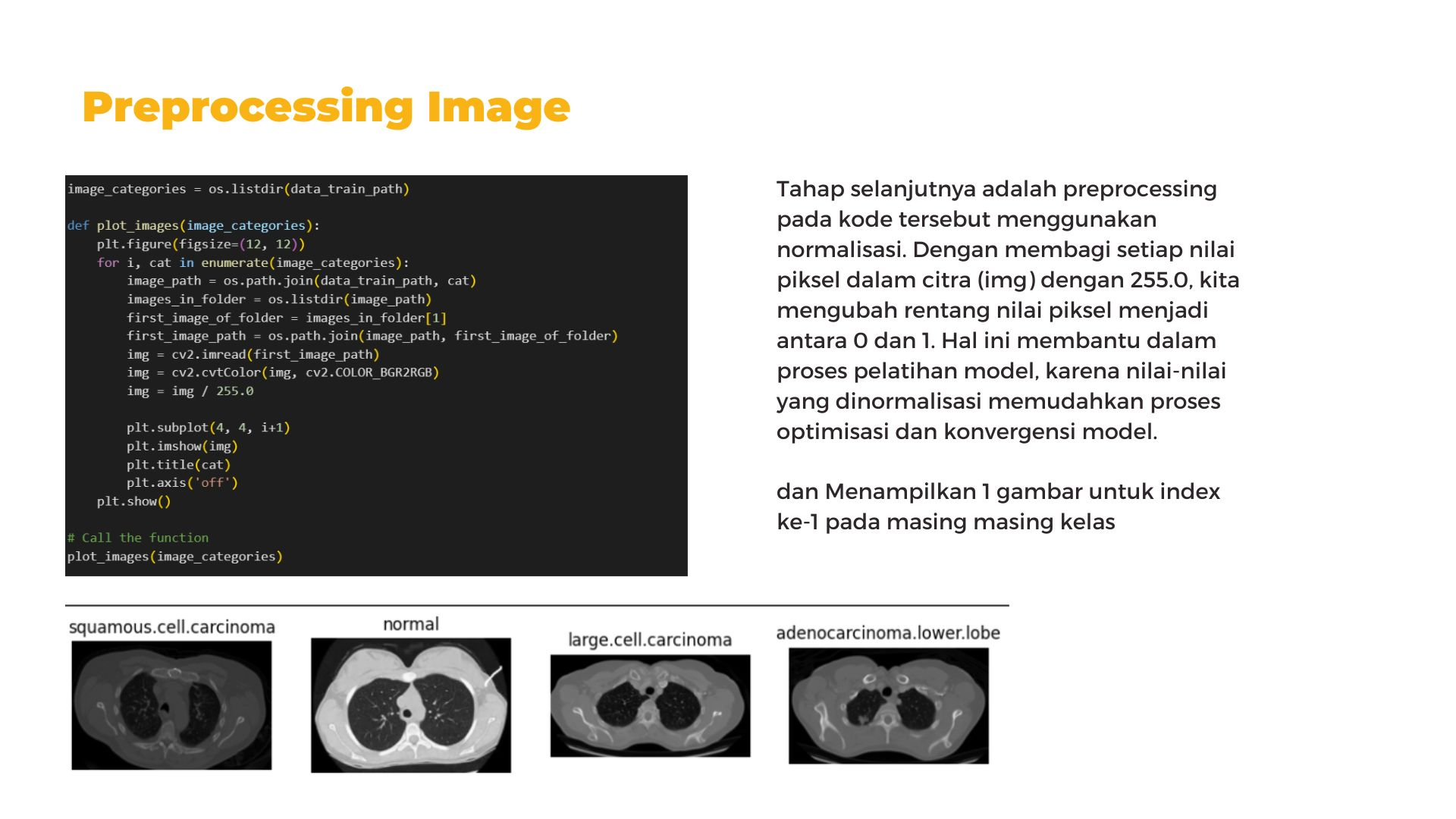 Portofolio Detail >> Chest CT Scan Classification with Deep Learning
